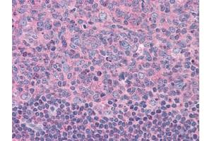 Human Tonsil: Formalin-Fixed, Paraffin-Embedded (FFPE) (ELP3/KAT9 anticorps)