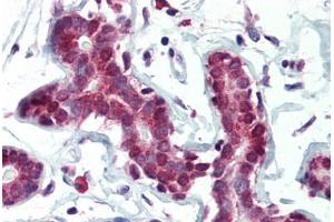 Human Breast (formalin-fixed, paraffin-embedded) stained with SETD7 antibody ABIN364315 at 5 ug/ml followed by biotinylated anti-mouse IgG secondary antibody ABIN481714, alkaline phosphatase-streptavidin and chromogen. (SETD7 anticorps)