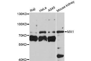 Western blot analysis of extracts of various cell lines, using MX1 antibody (ABIN5970897) at 1:3000 dilution. (MX1 anticorps)