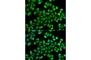 Immunofluorescence analysis of A549 cells using MAPKAPK3 antibody (ABIN5974743). (MAPKAP Kinase 3 anticorps)