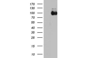 Western Blotting (WB) image for anti-Angiotensin I Converting Enzyme 2 (ACE2) (AA 18-237) antibody (ABIN2715653) (ACE2 anticorps  (AA 18-237))