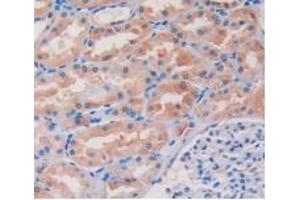 IHC-P analysis of Human Kidney Tissue, with DAB staining. (ITGB1 anticorps  (AA 140-383))
