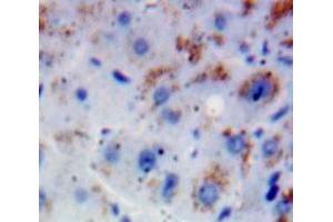 Used in DAB staining on fromalin fixed paraffin-embedded Liver tissue (FGFR2 anticorps  (AA 157-377))