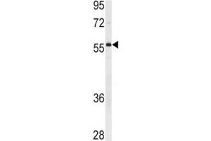 Western blot analysis of XIAP antibody and Ramos lysate.