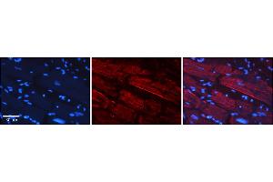 Rabbit Anti-GREB1 Antibody    Formalin Fixed Paraffin Embedded Tissue: Human Adult heart  Observed Staining: Membrane, Cytoplasmic Primary Antibody Concentration: 1:600 Secondary Antibody: Donkey anti-Rabbit-Cy2/3 Secondary Antibody Concentration: 1:200 Magnification: 20X Exposure Time: 0.