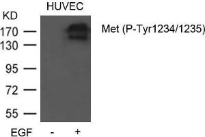 Western blot analysis of extracts from HUVEC cells untreated or treated with EGF using Met (Phospho-Tyr1234/1235) Antibody. (c-MET anticorps  (pTyr1234, pTyr1235))