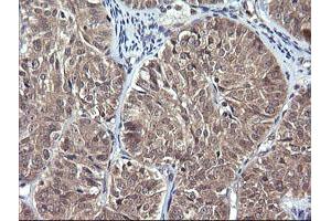 anti-Interleukin 1 Family Member 9 (IL1F9) antibody