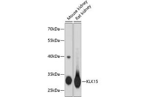 Western blot analysis of extracts of various cell lines, using KLK15 antibody (ABIN3016614, ABIN3016615, ABIN3016616 and ABIN6219799) at 1:3000 dilution. (Kallikrein 15 anticorps  (AA 80-180))