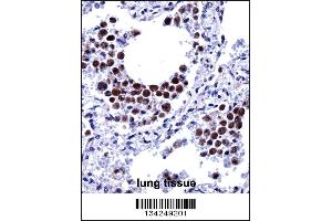 ARIH2 Antibody immunohistochemistry analysis in formalin fixed and paraffin embedded human lung tissue followed by peroxidase conjugation of the secondary antibody and DAB staining.