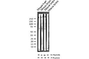 Western blot analysis of Phospho-LKB1 (Thr189) expression in various lysates