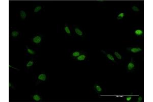 Immunofluorescence of monoclonal antibody to RNASEH2C on HeLa cell.