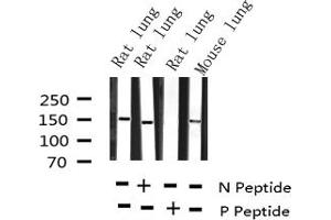 Western blot analysis of Phospho-KIT (Tyr703) expression in various lysates (KIT anticorps  (pTyr703))
