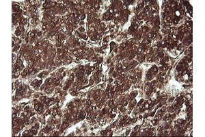 Image no. 5 for anti-Receptor Accessory Protein 5 (REEP5) antibody (ABIN1500659)