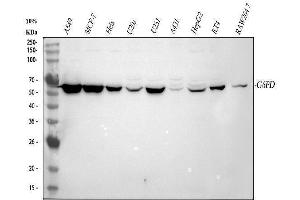 Western blot analysis of G6PD using anti-G6PD antibody (ABIN3042413).