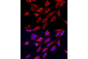 Immunofluorescence analysis of C6 cells using GAMT Rabbit pAb (ABIN6130447, ABIN6140950, ABIN6140951 and ABIN6222280) at dilution of 1:200 (40x lens).