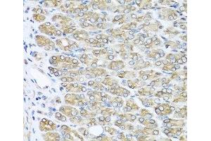 Immunohistochemistry of paraffin-embedded Mouse stomach using RAC2 Polyclonal Antibody at dilution of 1:100 (40x lens).