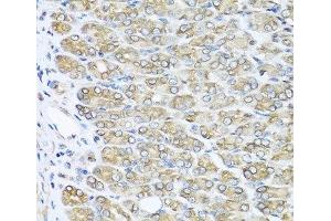 Immunohistochemistry of paraffin-embedded Mouse stomach using RAC2 Polyclonal Antibody at dilution of 1:100 (40x lens). (RAC2 anticorps)