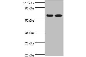 Western blot All lanes: SPATS2L antibody at 8 μg/mL Lane 1: CEM whole cell lysate Lane 2: HepG2 whole cell lysate Secondary Goat polyclonal to rabbit IgG at 1/10000 dilution Predicted band size: 62, 55, 66, 63 kDa Observed band size: 62 kDa (SPATS2L anticorps  (AA 2-488))