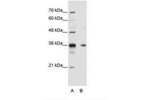 Image no. 1 for anti-Nanos Homolog 1 (NANOS1) (AA 157-206) antibody (ABIN202175) (Nanos Homolog 1 anticorps  (AA 157-206))