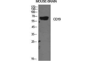 Western Blot (WB) analysis of Mouse Brain cells using CD19 Polyclonal Antibody. (CD19 anticorps  (Internal Region))