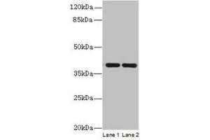 Western blot All lanes: CCDC42 antibody at 0. (CCDC42 anticorps  (AA 1-242))