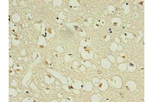 Immunohistochemistry of paraffin-embedded human brain using ABIN7161735 in 30 μg/mL dilute concentrations.