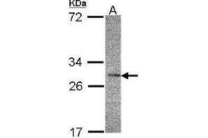 WB Image Sample(30 μg of whole cell lysate) A:HeLa S3, 12% SDS PAGE antibody diluted at 1:200 (IL22RA2 anticorps)