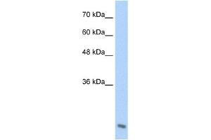WB Suggested Anti-AES Antibody Titration:  2. (AES anticorps  (C-Term))