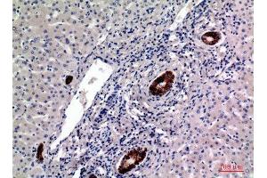 Immunohistochemistry (IHC) analysis of paraffin-embedded Human Liver, antibody was diluted at 1:100. (CD19 anticorps  (Internal Region))