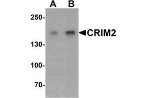 Western blot analysis of CRIM2 in Jurkat cell lysate with CRIM2 Antibody  at (A) 1 and (B) 2 ug/ml. (KCP anticorps  (C-Term))