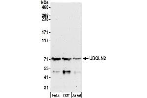 Western Blotting (WB) image for anti-Ubiquilin 2 (UBQLN2) (AA 1-50) antibody (ABIN7450867)