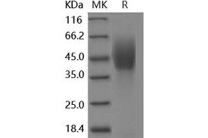 Western Blotting (WB) image for Niemann-Pick Disease, Type C1 (NPC1) protein (His tag,DYKDDDDK Tag) (ABIN7317151)