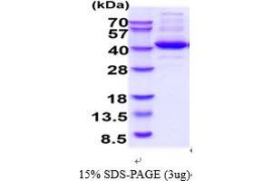SDS-PAGE (SDS) image for Aldolase C, Fructose-Bisphosphate (ALDOC) (AA 1-364) protein (ABIN5854638)