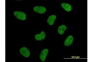 Immunofluorescence of purified MaxPab antibody to DFFA on HeLa cell.