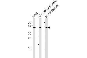 Western blot analysis of lysates from Hela cell line, mouse skeletal muscle and mouse cerebellum tissue lysate(from left to right), using Mouse Hoxc10 Antibody at 1:1000 at each lane. (HOXC10 anticorps  (C-Term))