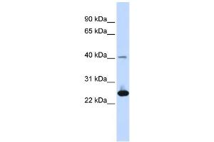 WB Suggested Anti-SELS Antibody Titration: 0. (Selenoprotein S anticorps  (Middle Region))