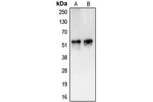 Western blot analysis of CAMKV expression in HL60 (A), HuvEc (B) whole cell lysates. (CAMKV anticorps  (Center))