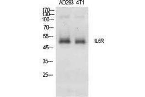 Western Blotting (WB) image for anti-Interleukin 6 Receptor, alpha (IL6RA) (Internal Region) antibody (ABIN3181401) (IL6RA anticorps  (Internal Region))