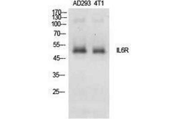 IL6RA anticorps  (Internal Region)