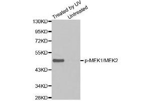 Western blot analysis of extracts from Hela cell untreated or treated with UV using Phospho-MAP2K1/MAP2K2-S217/S221 antibody