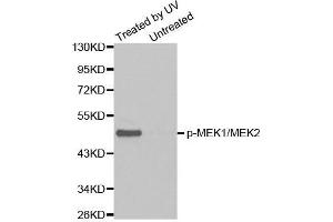 Western blot analysis of extracts from Hela cell untreated or treated with UV using Phospho-MAP2K1/MAP2K2-S217/S221 antibody (MEK1 anticorps  (pSer221, Ser217, Ser221))