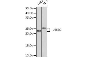 Western blot analysis of extracts of various cell lines, using UBE2C Rabbit mAb (ABIN1680590, ABIN3019392, ABIN3019393 and ABIN7101768) at 1:1000 dilution. (UBE2C anticorps)