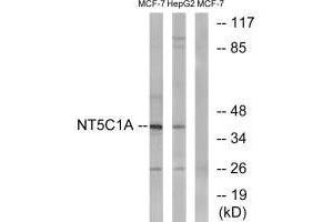 Western blot analysis of extracts from MCF-7 cells and HepG2 cells, using NT5C1A antibody. (NT5C1A anticorps)