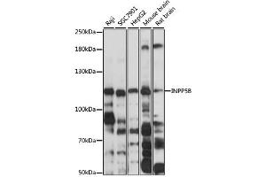 Western blot analysis of extracts of various cell lines, using INPP5B antibody (ABIN6292588) at 1:3000 dilution. (INPP5B anticorps)