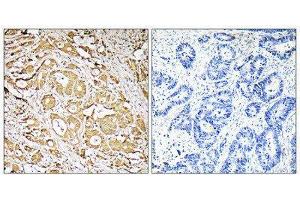 Immunohistochemistry (IHC) image for anti-Fucosyltransferase 3 (Galactoside 3(4)-L-Fucosyltransferase, Lewis Blood Group) (FUT3) (Internal Region) antibody (ABIN1851348) (FUT3 anticorps  (Internal Region))