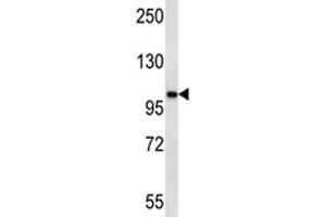 AR antibody western blot analysis in ZR-75-1 lysate