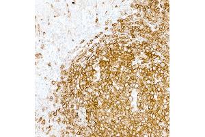 Immunohistochemistry (IHC) image for anti-HLA-DR (HLA-DR) antibody (ABIN7449537) (HLA-DR anticorps)