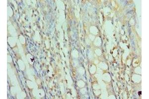 Immunohistochemistry of paraffin-embedded human colon tissue using ABIN7170676 at dilution of 1:100 (SRPK1 anticorps  (AA 290-480))