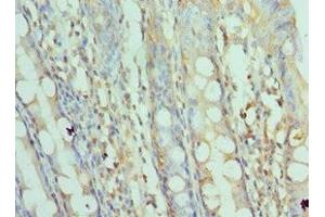 Immunohistochemistry of paraffin-embedded human colon tissue using ABIN7170676 at dilution of 1:100 (SRPK1 anticorps  (AA 290-480))