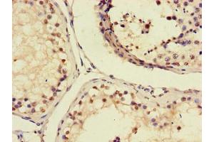 Immunohistochemistry of paraffin-embedded human testis tissue using ABIN7156703 at dilution of 1:100 (AIM2 anticorps  (AA 81-326))